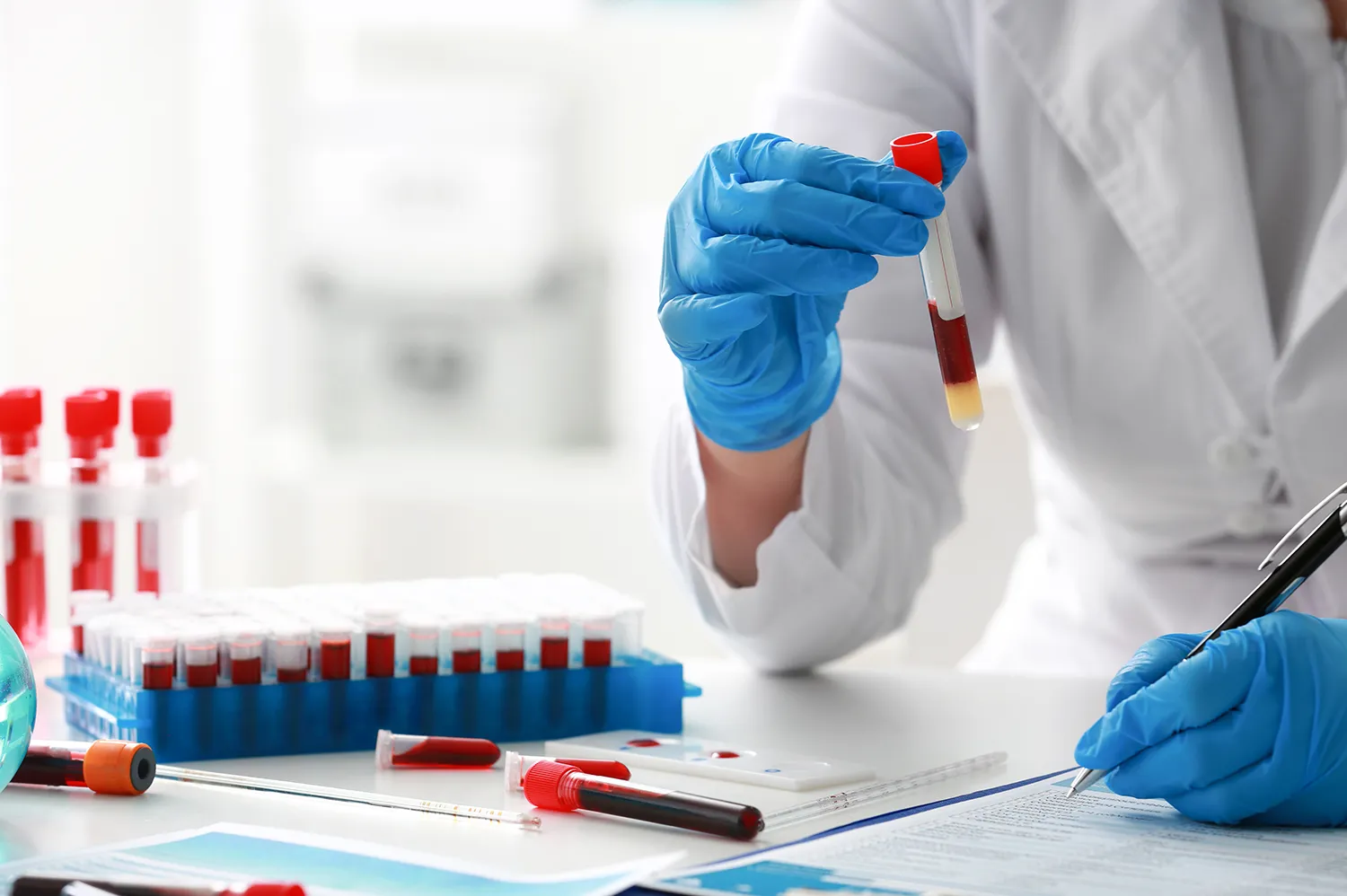Blood Test Packages